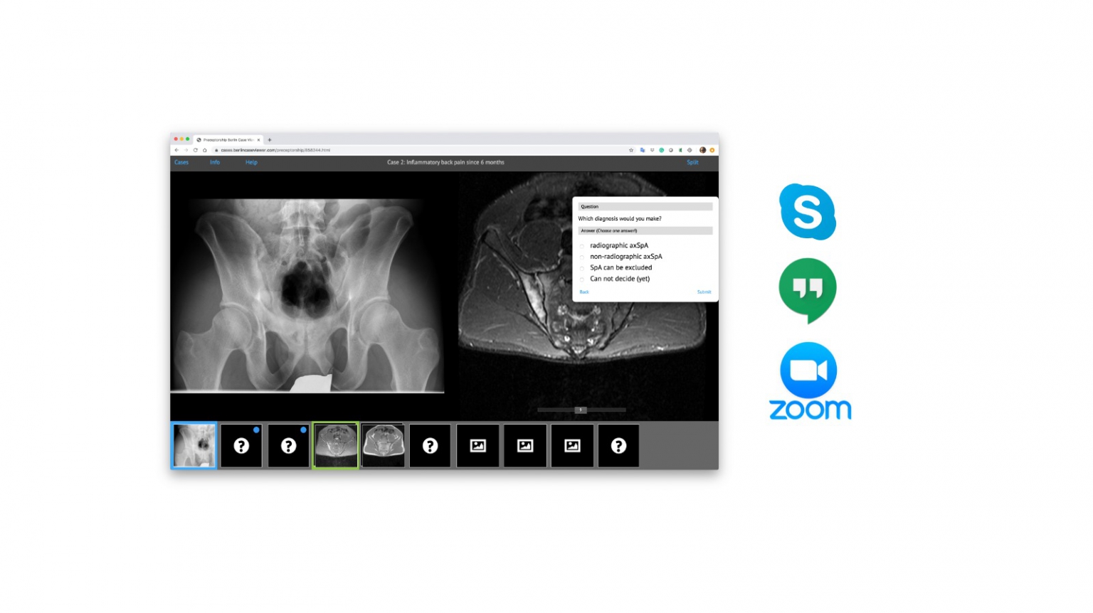 Remote Learning: BerlinCaseViewer Streaming Live