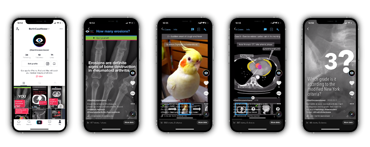 How to learn with TikTok and BerlinCaseViewer: Radiology in your feed