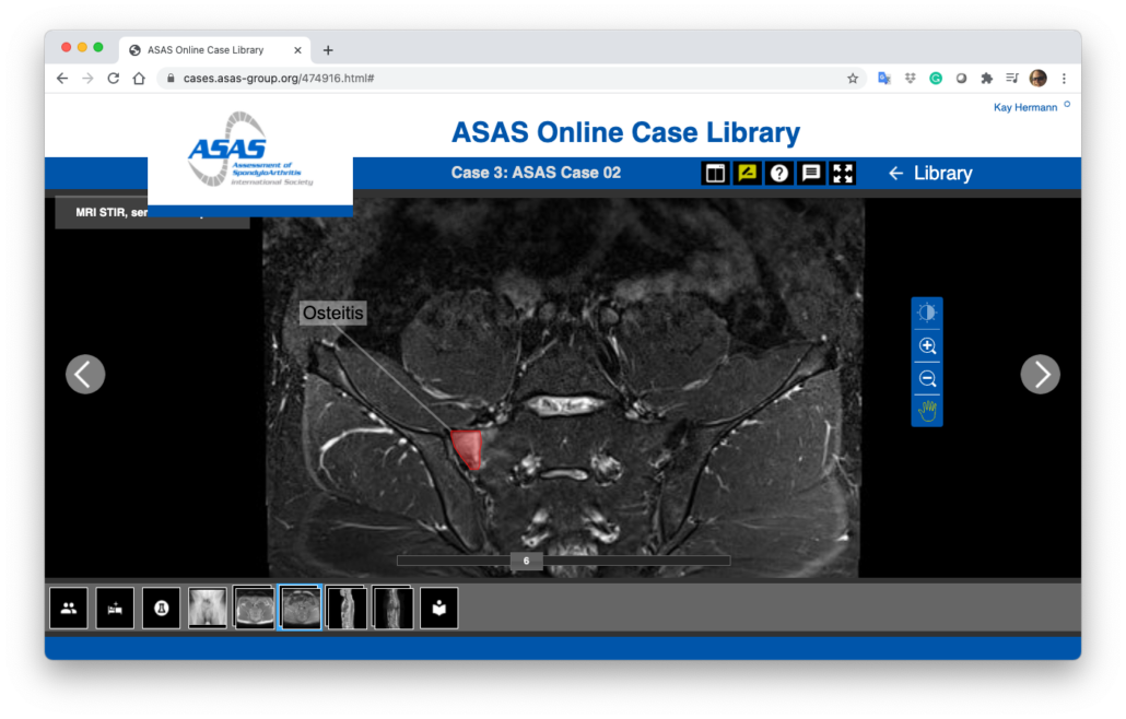 Webbrowser showing version 2 of the ASAS Online Case Library