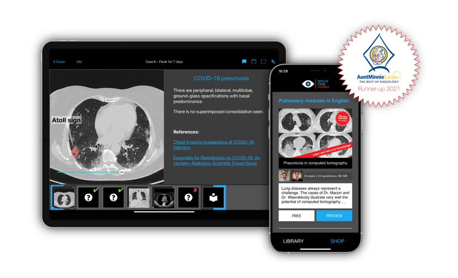 Best New Radiology Software: BerlinCaseViewer belegt den 2. Platz bei den 2021 EuroMinnies Awards