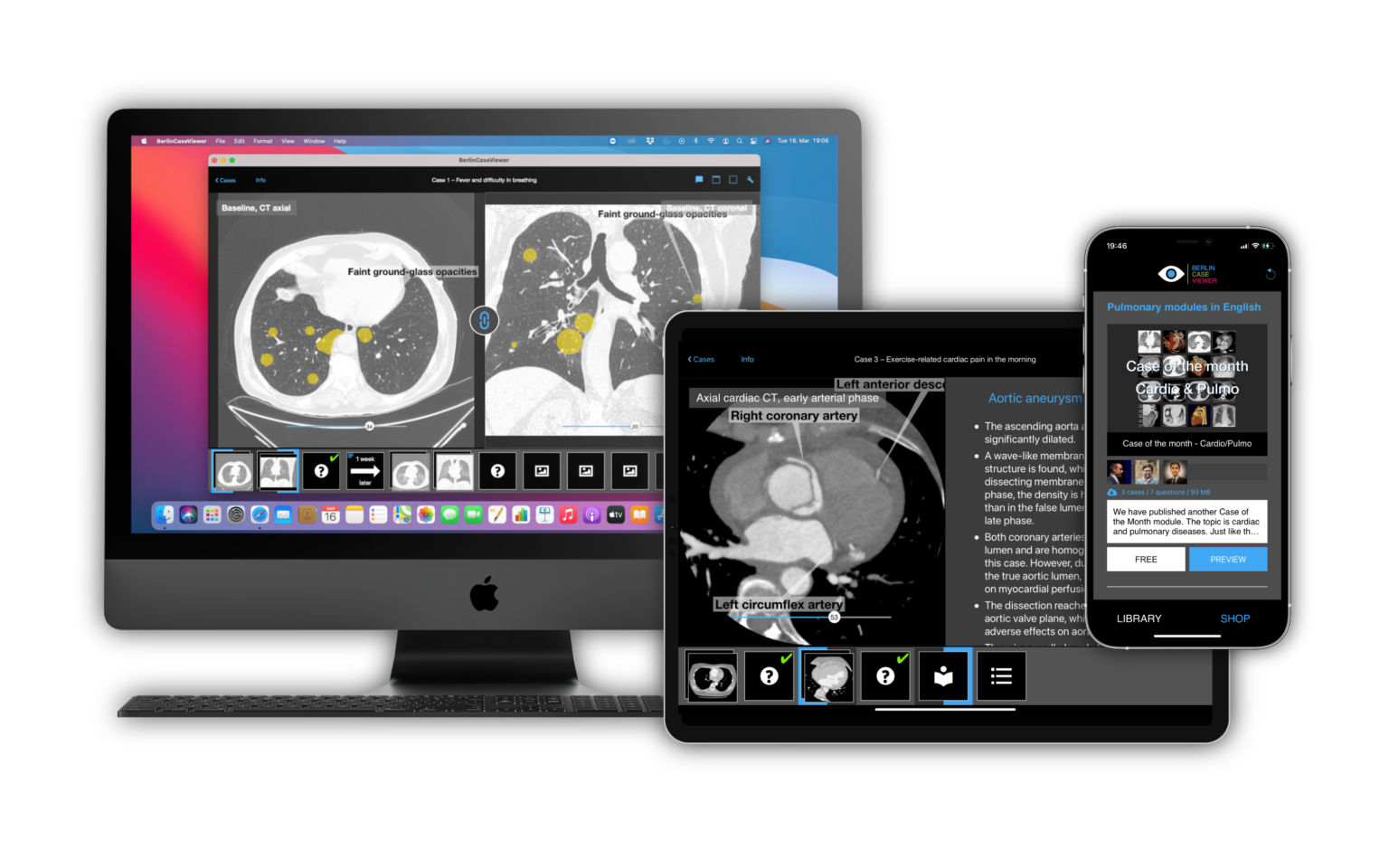 New module: Case of the Month “Cardio/Pulmo”