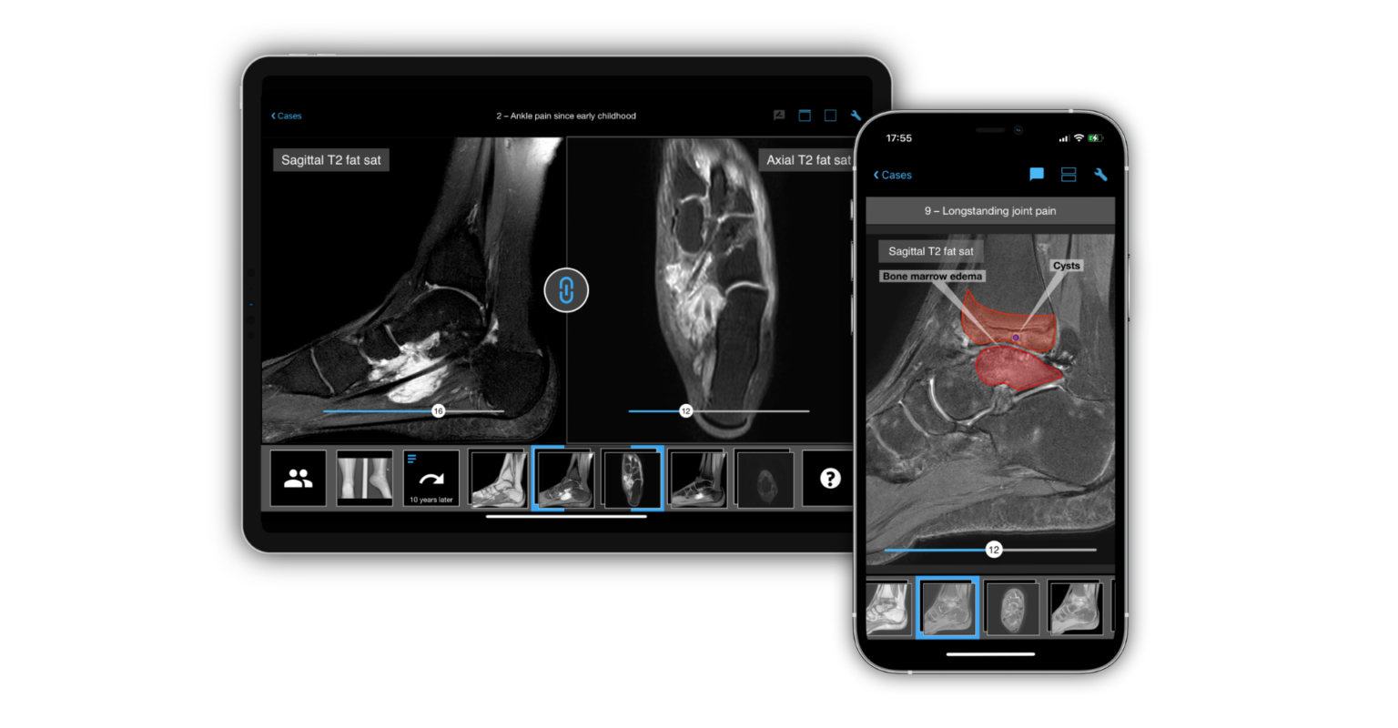 Radiologie von Sprunggelenk und Fuß: Neues Modul im BerlinCaseViewer