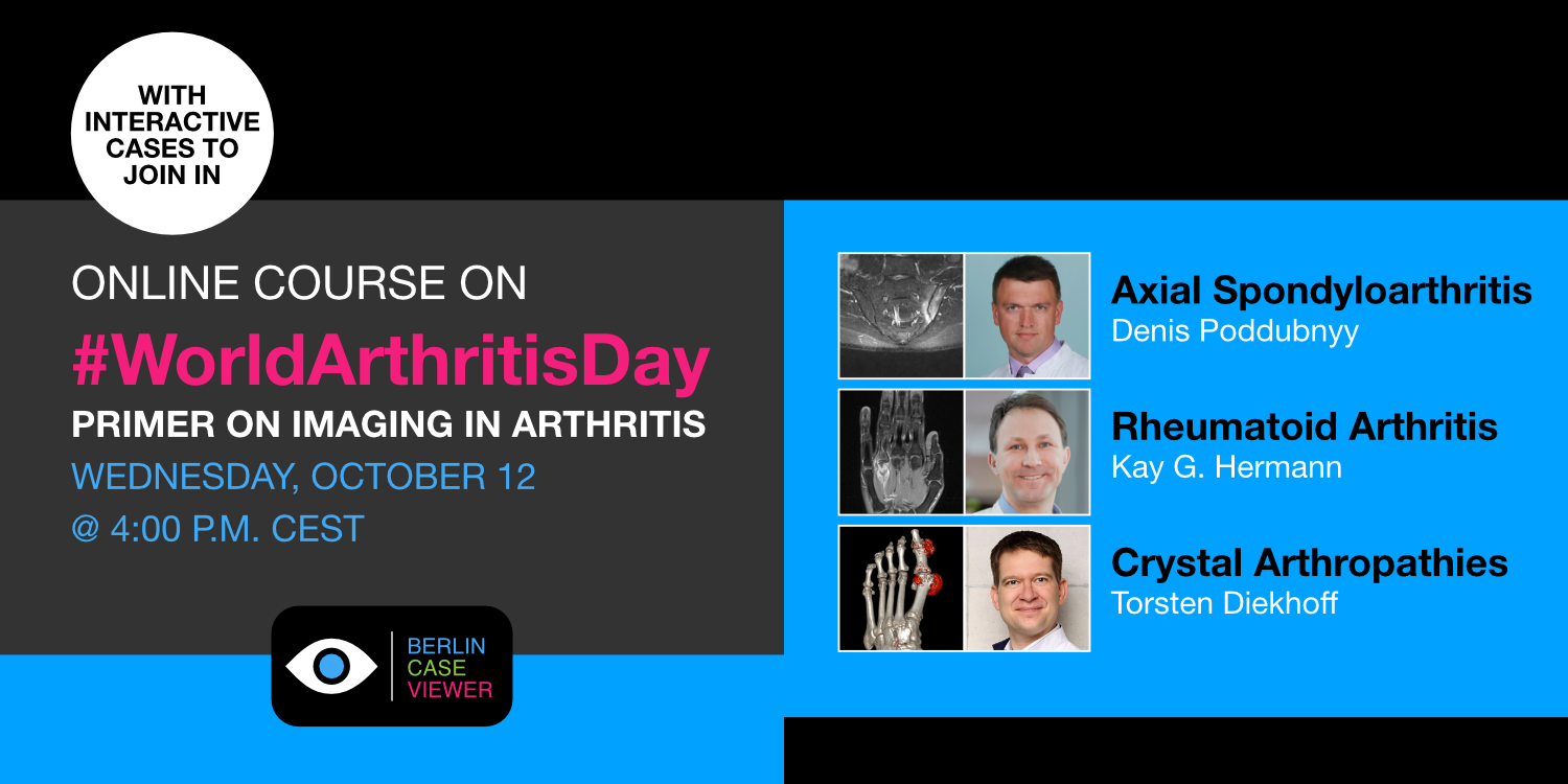 Learn More About Arthritides and Zoom in for World Arthritis Day (WAD)