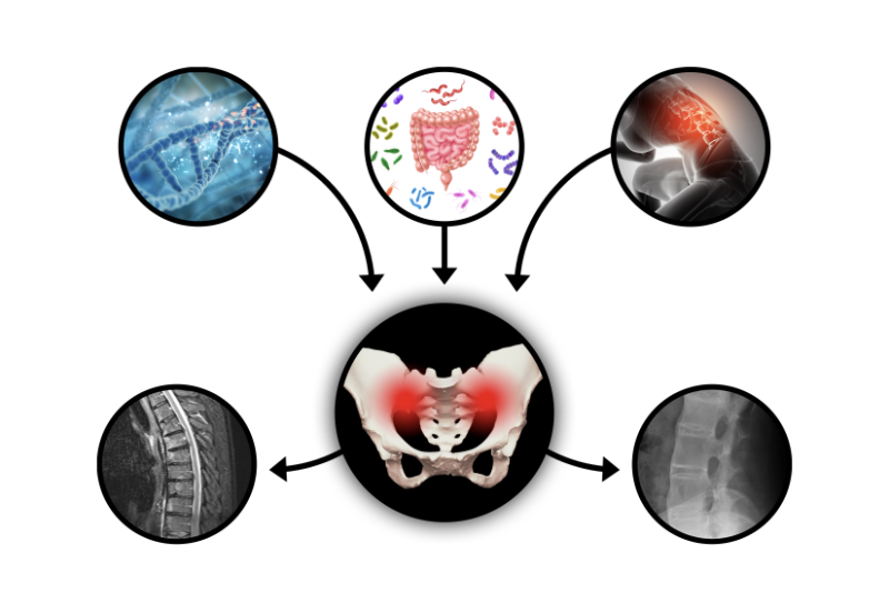 Axiale Spondyloarthritis in Forschung und Lehre – Joachim Sieper im Interview (Teil 2)