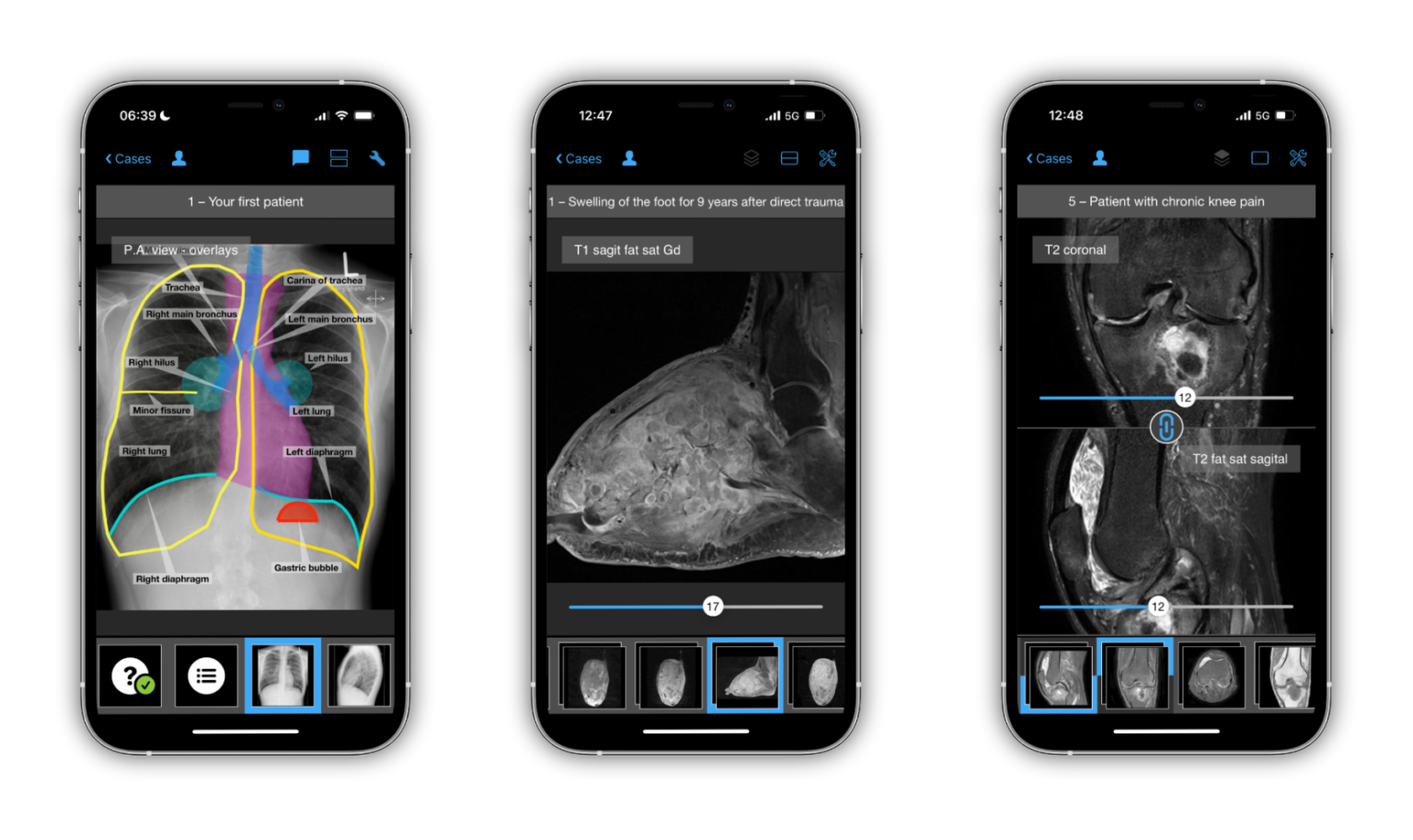 The year 2023 in preview: What’s in store for the BerlinCaseViewer?