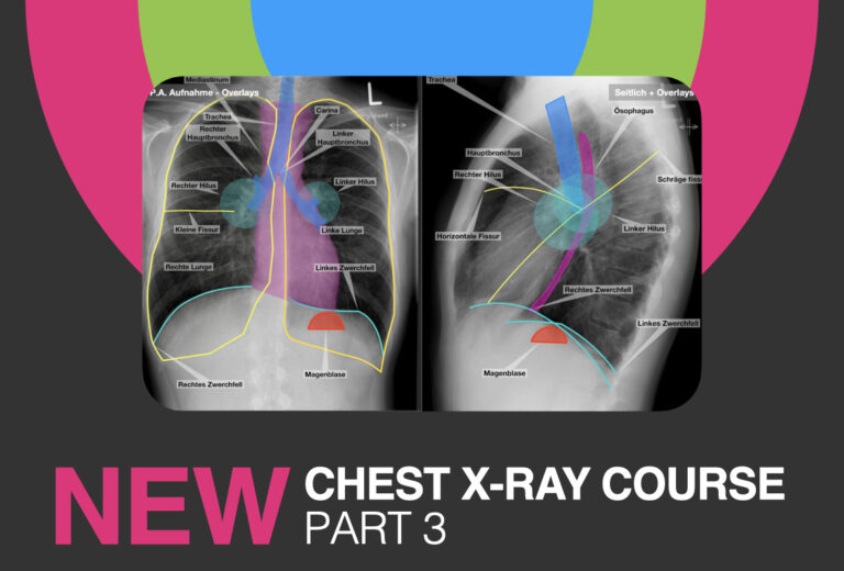 Chest X-ray Trainer | Part 3