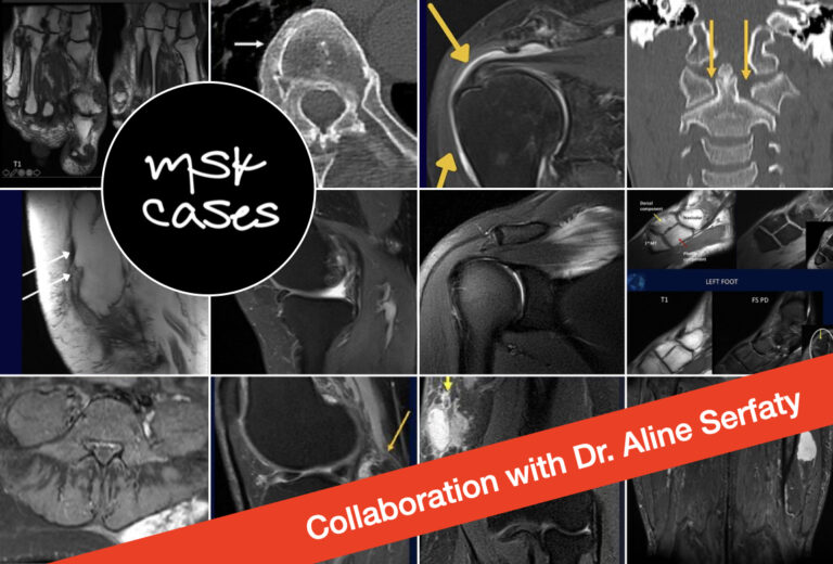 MSK.cases Dr. Aline Serfaty