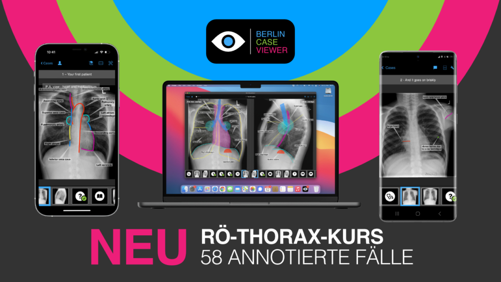 #IDoR2023: Brandneues Röntgen-Thorax-Modul zum Tag der Radiologie