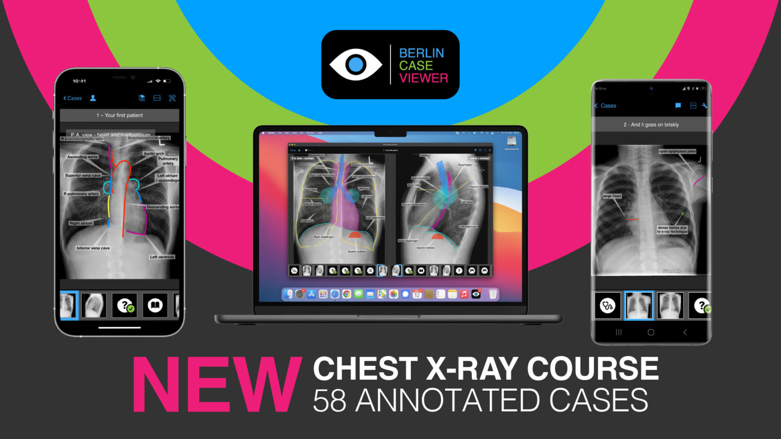 #IDoR2023: Brandnew Chest X-ray Module Celebrating International Day of Radiology