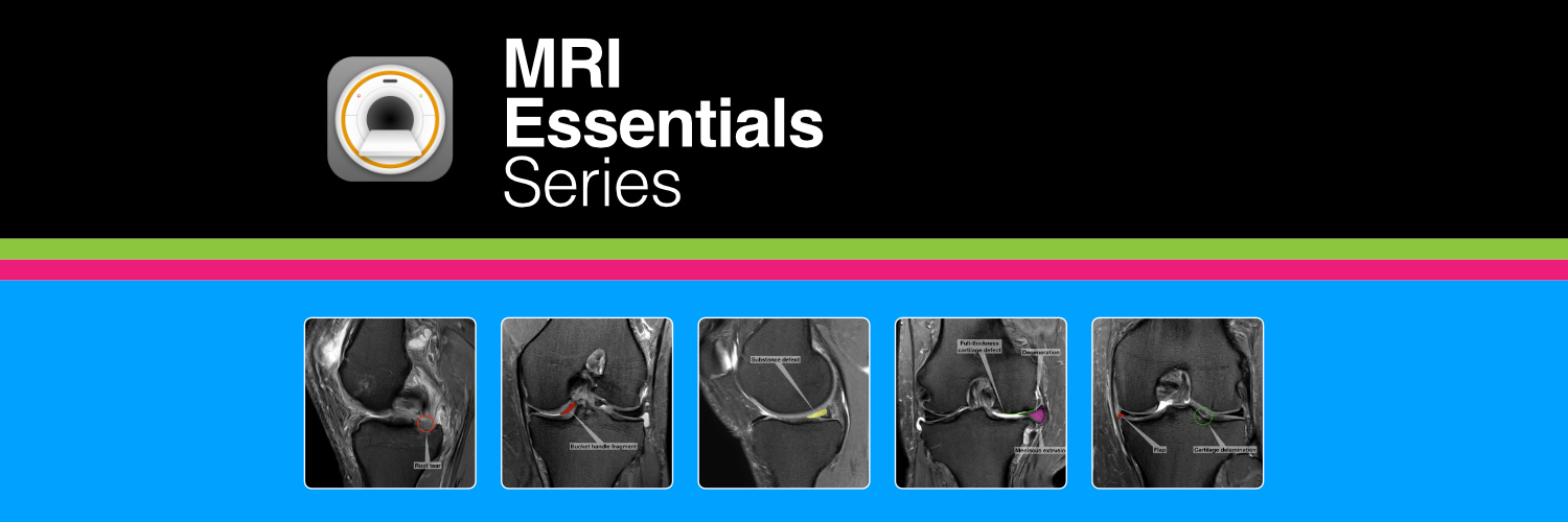 NEW: Module on MRI of the Knee Joint Focussing on Meniscus Injuries